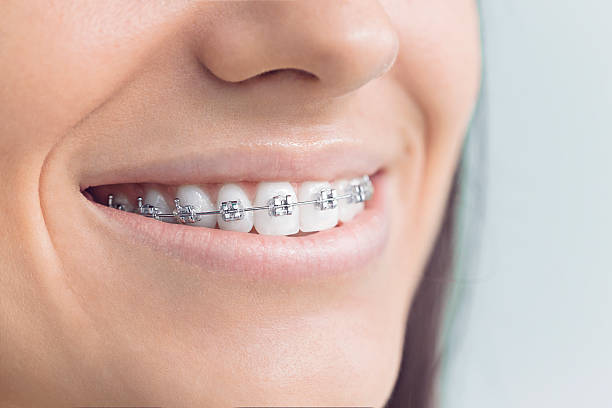 Best Wisdom Tooth Removal  in East Cleveland, TN